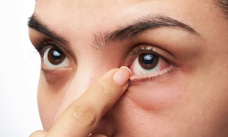 signs of unhealthy eyes