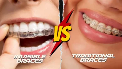 Invisible Braces vs Traditional Braces