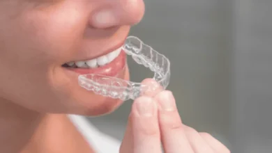 braces for underbite
