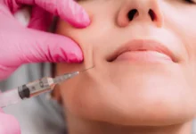 injectable fillers