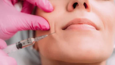 injectable fillers